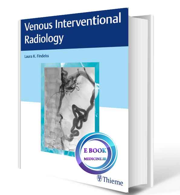 دانلود کتاب Venous Interventional Radiology2020 (Original PDF)